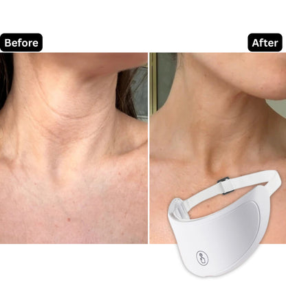 NightHalo™ Neck Therapy